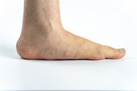 Two Categories of Flat Feet