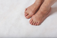 How Footwear Affects Hammertoe