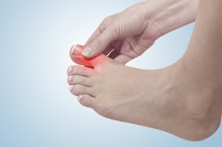 What Is Hallux Rigidus?