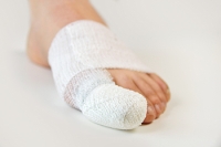 A Common Treatment Option for a BrokenToe